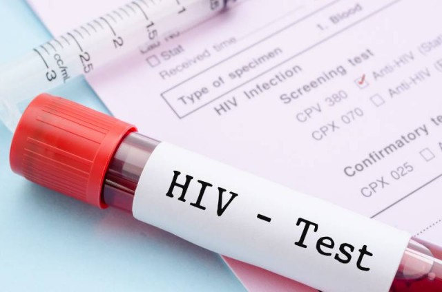 hiv-teste
